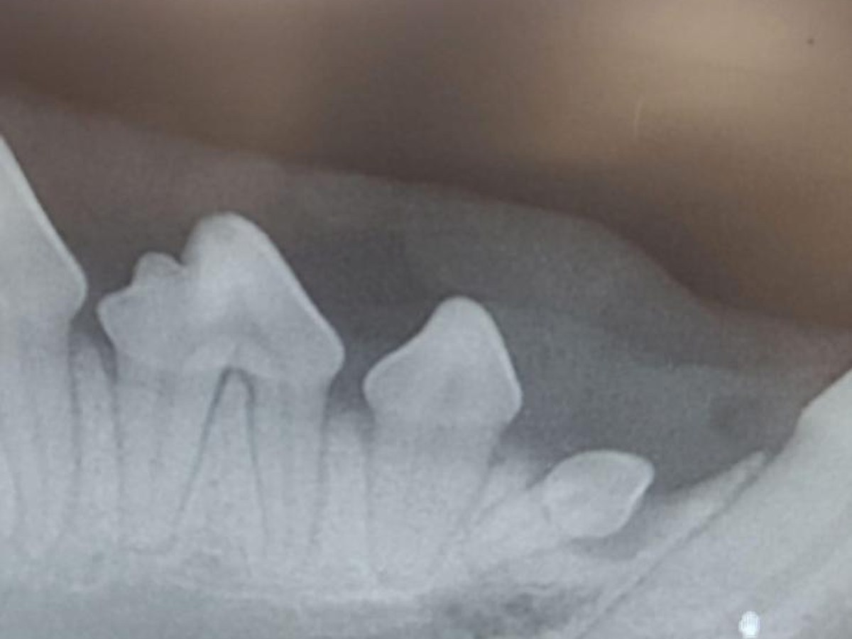 A dental radiograph taken at Downwood, showing tooth roots below the gum line